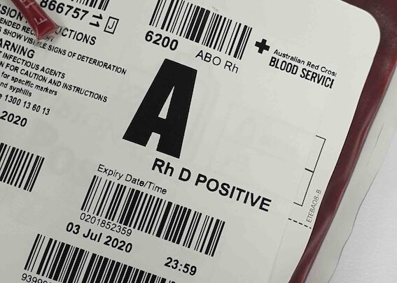 Krew podczas porodu – ile tracimy i kiedy to może być niebezpieczne