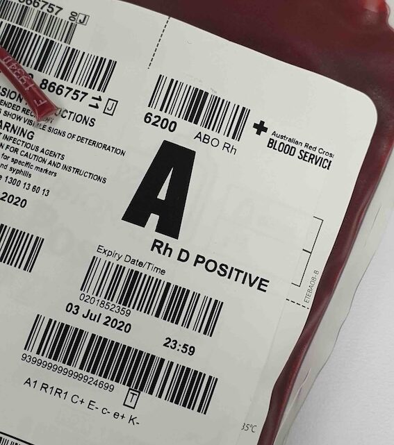 Krew podczas porodu – ile tracimy i kiedy to może być niebezpieczne